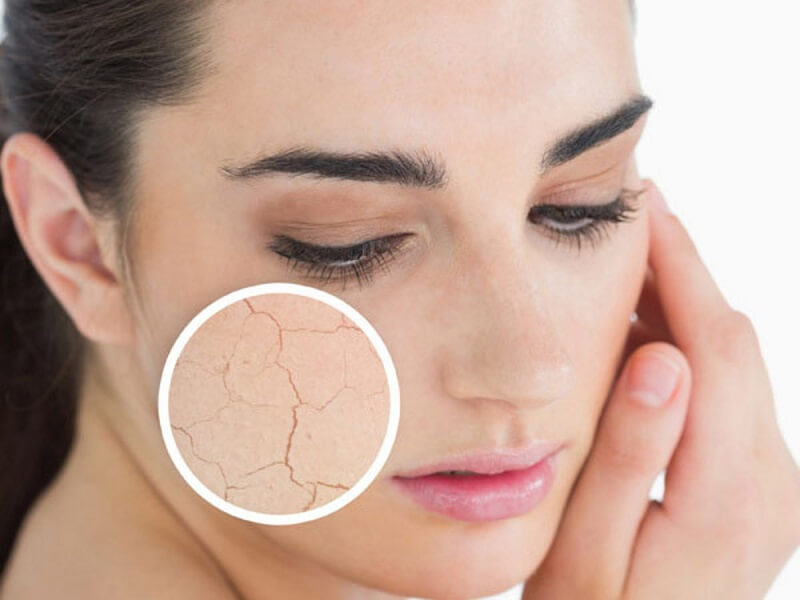 bí quyết [VÀNG] chăm sóc da mặt khô hiệu quả